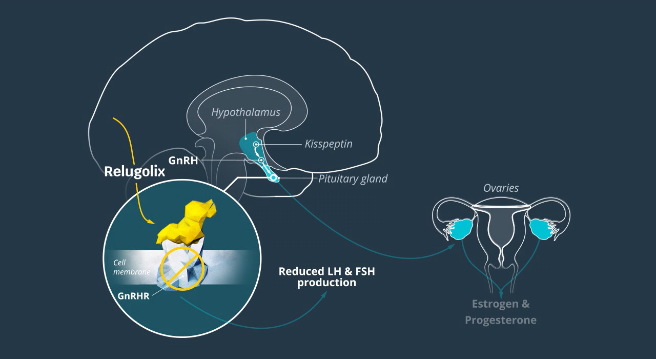 英国生物制药公司：Myovant Sciences Ltd.(MYOV)-图片2